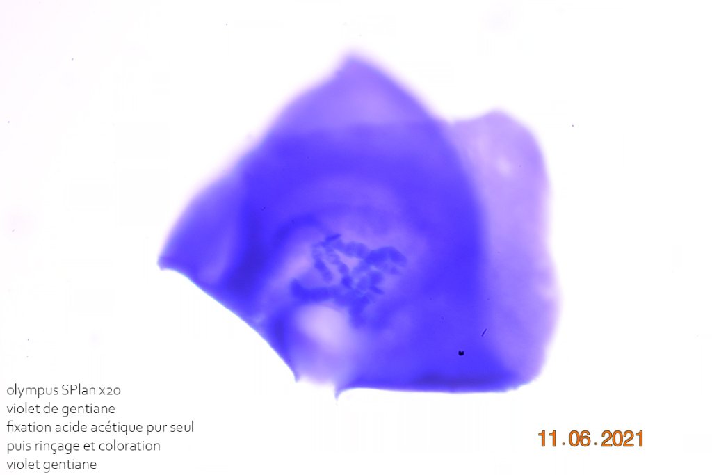 11 juin 21 chromosome chironome fixation acetique violet gentiane x20.jpg